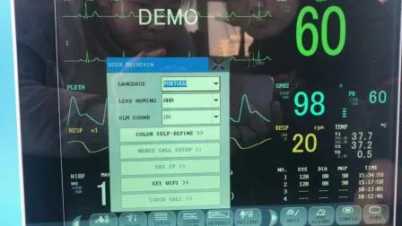 Monitor paziente della frequenza cardiaca Prezzo del monitor cardiaco umano portatile medico di alta qualità